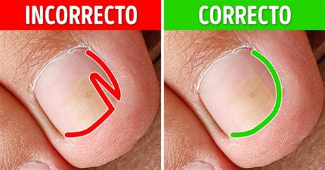 9 Formas efectivas de arreglar las uñas encarnadas en los dedos de los pies / Genial