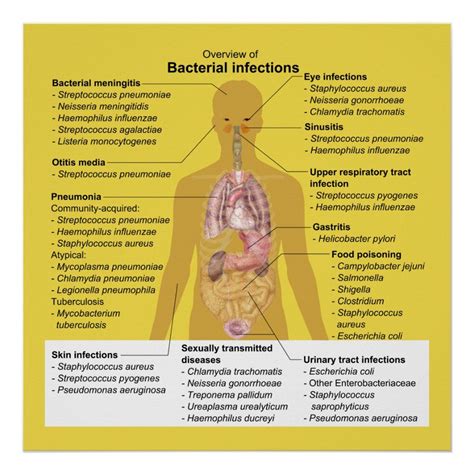 Overview of Bacterial Infections Poster | Zazzle | Bacterial infection, Infections ...