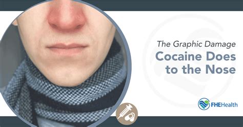 Damage Cocaine Does to the Nose; Long-term and Short-term | FHE Health