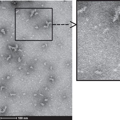 Negative stain electron microscopy of recombinant hybrid 1. Shown is a... | Download Scientific ...