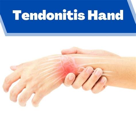 Tendonitis Hand Treatment in Pune Archives - The Prolotherapy Clinic