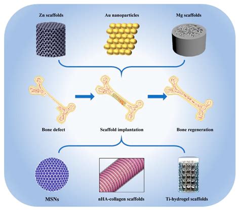 Nanomaterials | Free Full-Text | Novel Inorganic Nanomaterial-Based Therapy for Bone Tissue ...