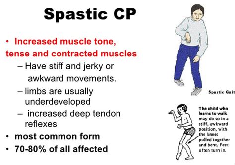 Pin on OT/OTA: Pediatric