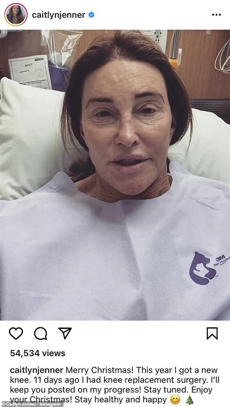 Caitlyn Jenner, 72, reveals she had knee replacement surgery | Daily ...