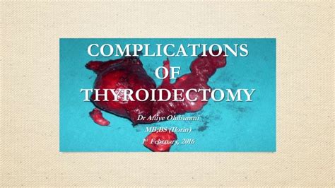 Complications of thyroidectomy