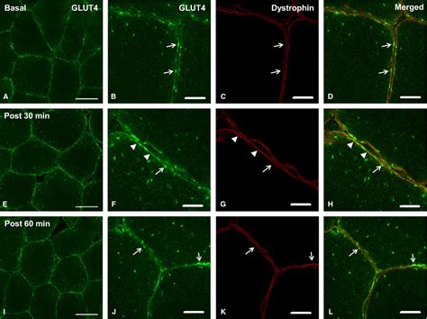 Visualization and quantitation of GLUT4 translocation in human skeletal muscle following glucose ...