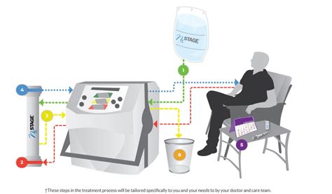 NxStage System One – Home Hemodialysis – MedView Systems