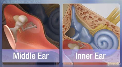 Mixed Hearing Loss | Pacific Northwest Audiology