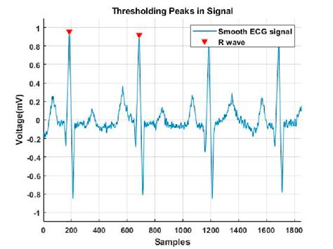 A sample of R-wave detection by applying the pick detection algorithm... | Download Scientific ...