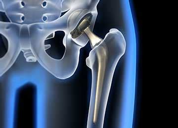 Pelvic Reconstruction Surgery Fourways Johannesburg