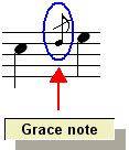 Editing the Music Notation > Editing Grace Notes > Understanding the Two Types of Grace Notes