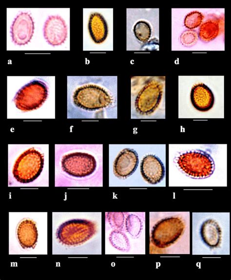 Spores of Ganoderma species (bar = 5 μm). a. Ganoderma applanatum; b ...