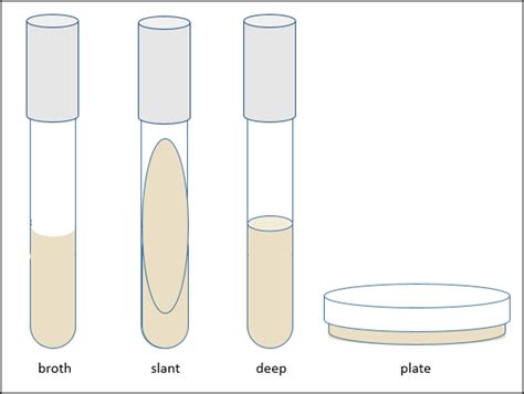 7: Aseptic Technique - Biology LibreTexts