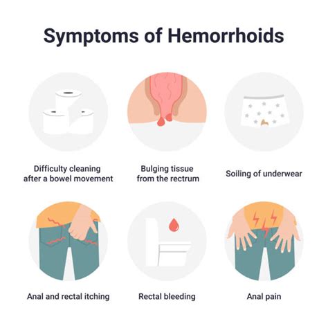 Postpartum Hemorrhoids: Symptoms, Causes, Treatments