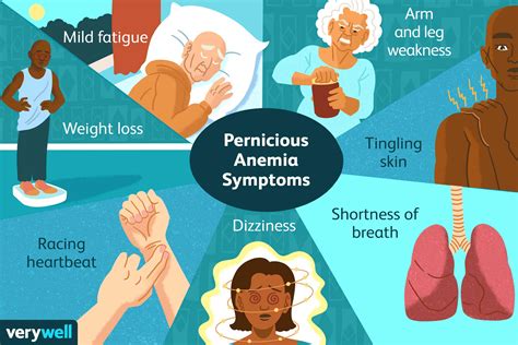 Pernicious Anemia: Symptoms, Causes, Diagnosis, and Treatment