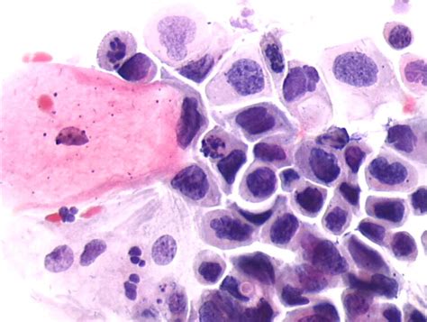 Cytopathology of the uterine cervix - digital atlas