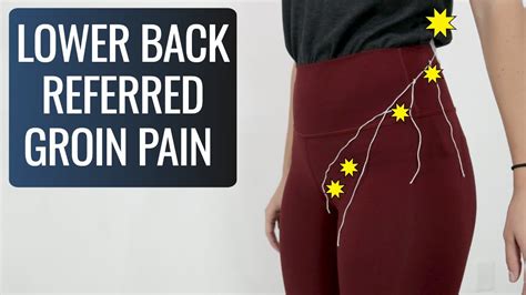 Can Low Back Pain Cause Groin Pain? Yes, Here's How - YouTube