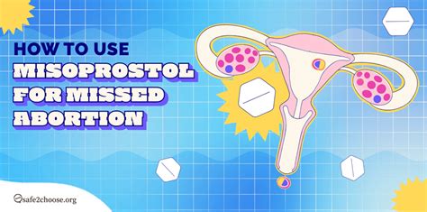 How to use misoprostol for a missed abortion and what the side effects are | safe2choose