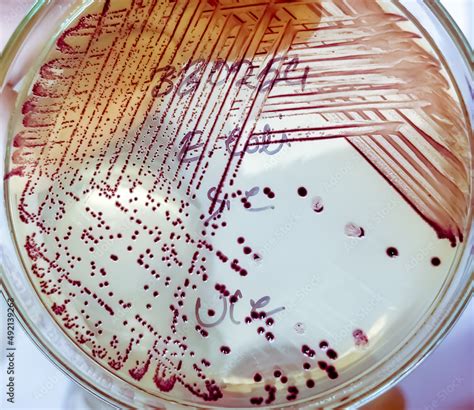 Bacteria colony of Escherichia coli (E.coli) in culture media plate ...