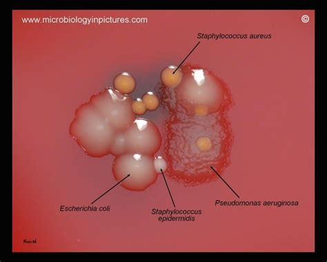 Medical laboratory science, Medical laboratory science student, Microbiology