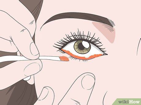 3 Ways to Treat Eyebrow and Eyelash Lice - wikiHow