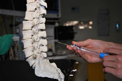 Painful vertebrae | General center | SteadyHealth.com