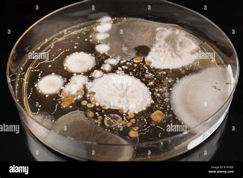 Petri dish colonies pathogenic bacteria hi-res stock photography and ...