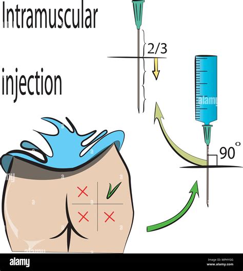 Intramuscular injection hi-res stock photography and images - Alamy