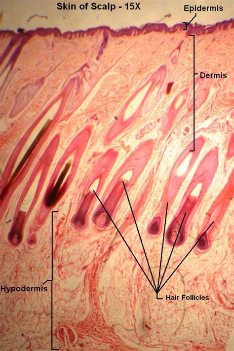 Skin of Scalp – Tutorial – Histology Atlas for Anatomy and Physiology