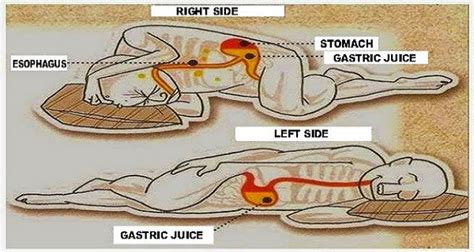 medical science - Does sleeping on your left side improve digestion ...