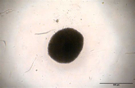 3D Spheroid | Organoid Biomodels | Biotect Lab Services - Biotect Services