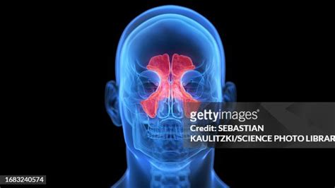 Inflamed Sinuses Illustration High-Res Vector Graphic - Getty Images