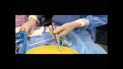 Tenckhoff 氏導管插入術 Insertion of Tenckhoff's catheter - YouTube