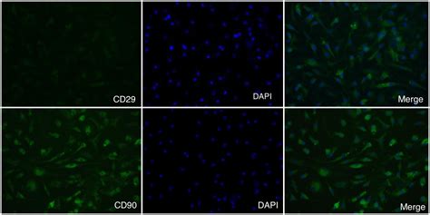 Effects of Bone Marrow Mesenchymal Stem Cells on Myelin Repair and ...