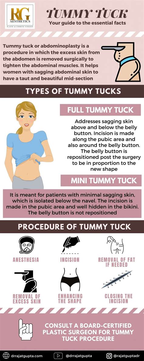 Mini tummy tuck recovery timeline - sealukraine