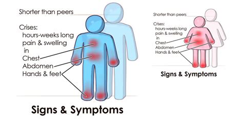 Health: Sickle Cell Anemia - Diary Of Doc Diva