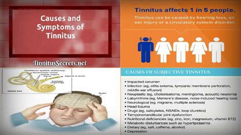 Tinnitus Symptoms - Everything You Need to Know About Tinnitus Symptoms - YouTube