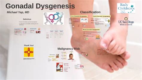 Gonadal Dysgenesis by Michael Yap on Prezi