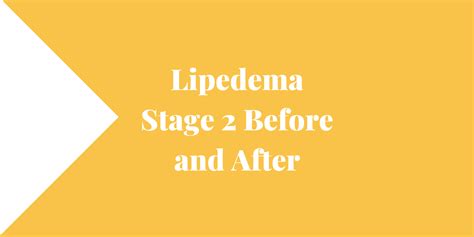 Lipedema Stage 2 Before and After - Lipedema and Me