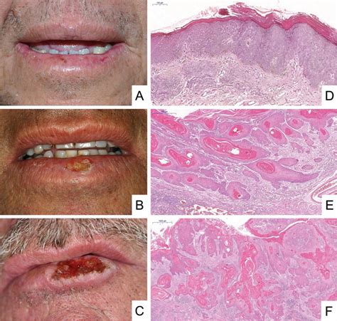 Histological Structure Of Lipsticks | Lipstutorial.org