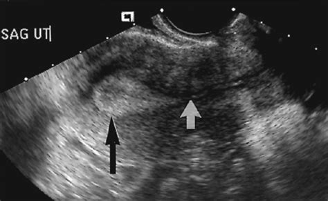 Female Pelvis Ultrasound | Radiology Key