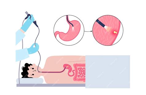 Premium Vector | Gastroscopy procedure Stomach polyps diagnostic ...