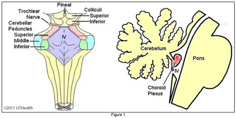 Pictures Of Cerebellar Peduncles