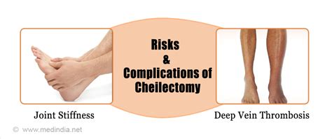 Cheilectomy - Types, Risks & Complications