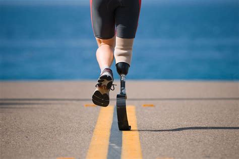 5 Inspirational Athletes with Prosthetic Devices