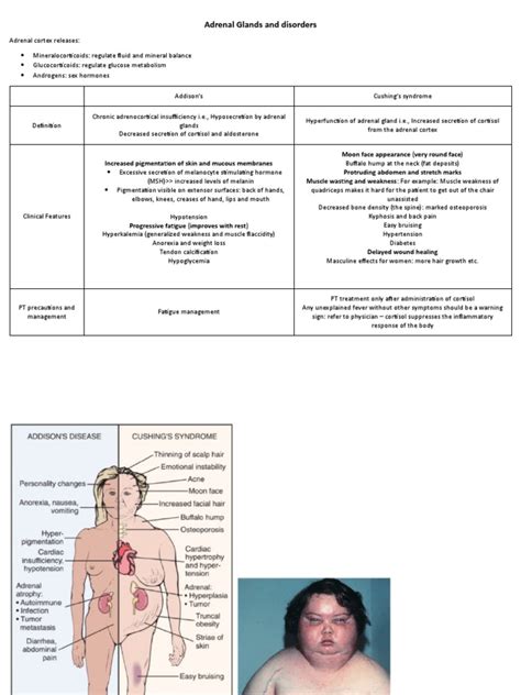 Addisons Vs Cushing | PDF | Adrenal Gland | Endocrinology