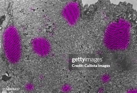 Light Micrograph Of Canine Adenovirus Type Iia High-Res Stock Photo - Getty Images