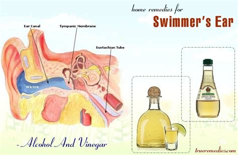 23 Effective Home Remedies For Swimmer's Ear Pain & Infections