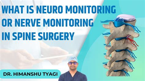 Neuro-Monitoring in Spine Surgery. - YouTube