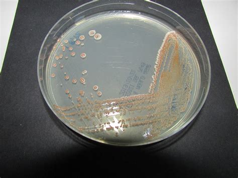 NCYC 2173 - Schizosaccharomyces pombe | National Collection of Yeast Cultures